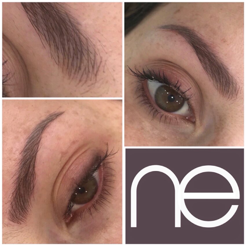 Natural Enhancement Semi Permanent Scar Camouflage Before And After