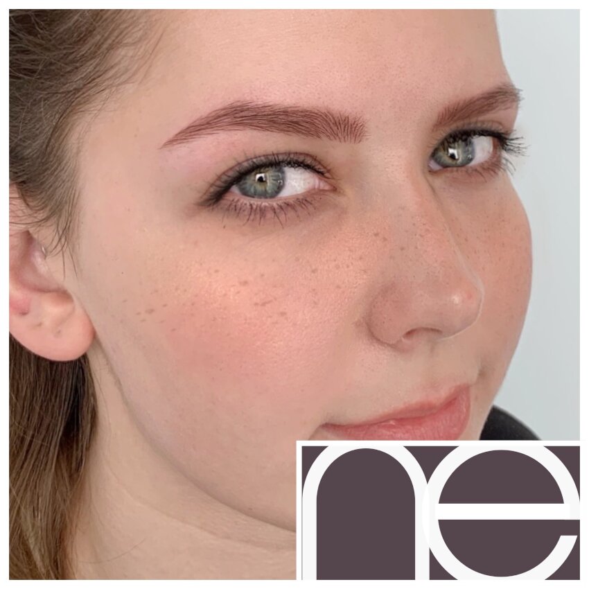 Natural Enhancement Semi Permanent Scar Camouflage Before And After