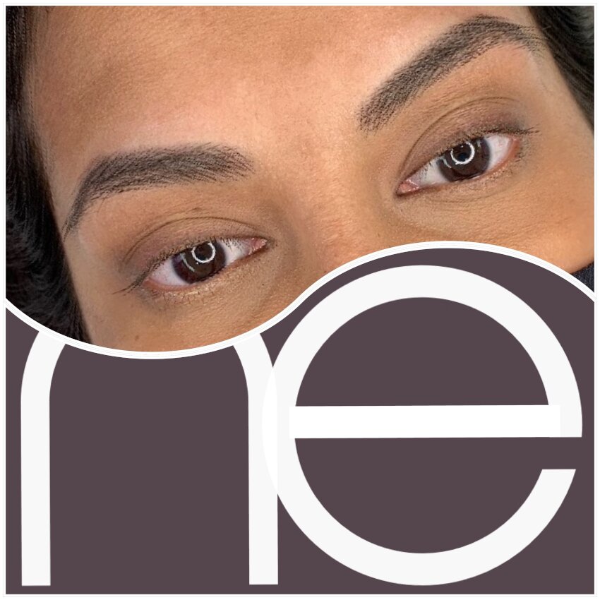 Natural Enhancement Semi Permanent Scar Camouflage Before And After