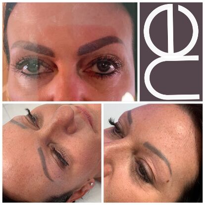 Natural Enhancement Semi Permanent Makeup Removal And Correction Before And After