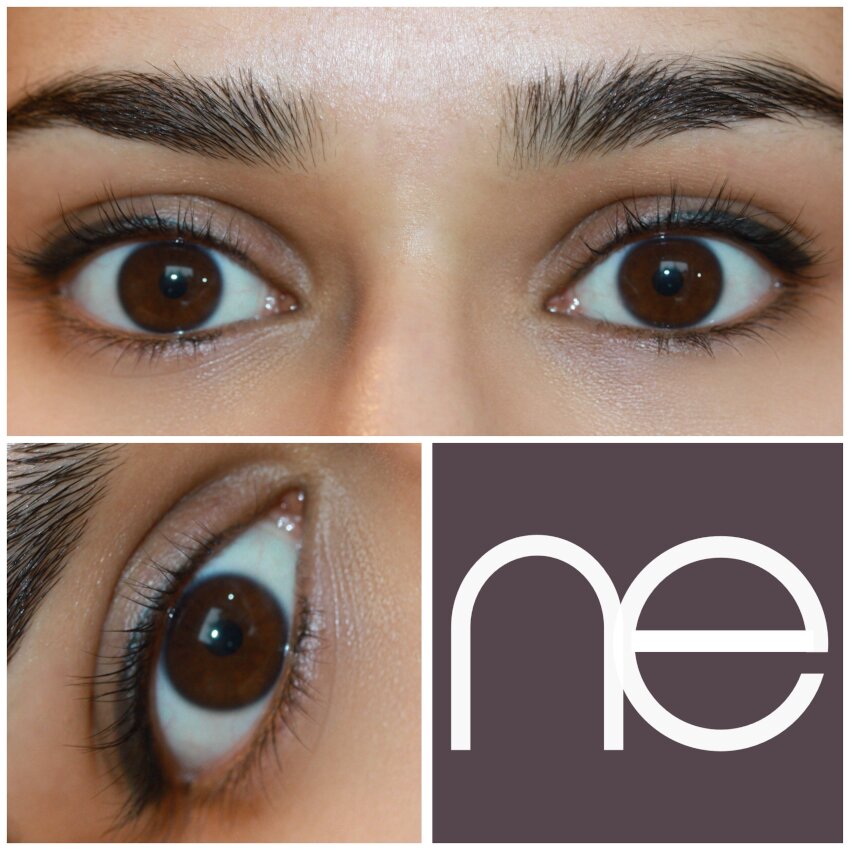 Natural Enhancement Semi Permanent Scar Camouflage Before And After