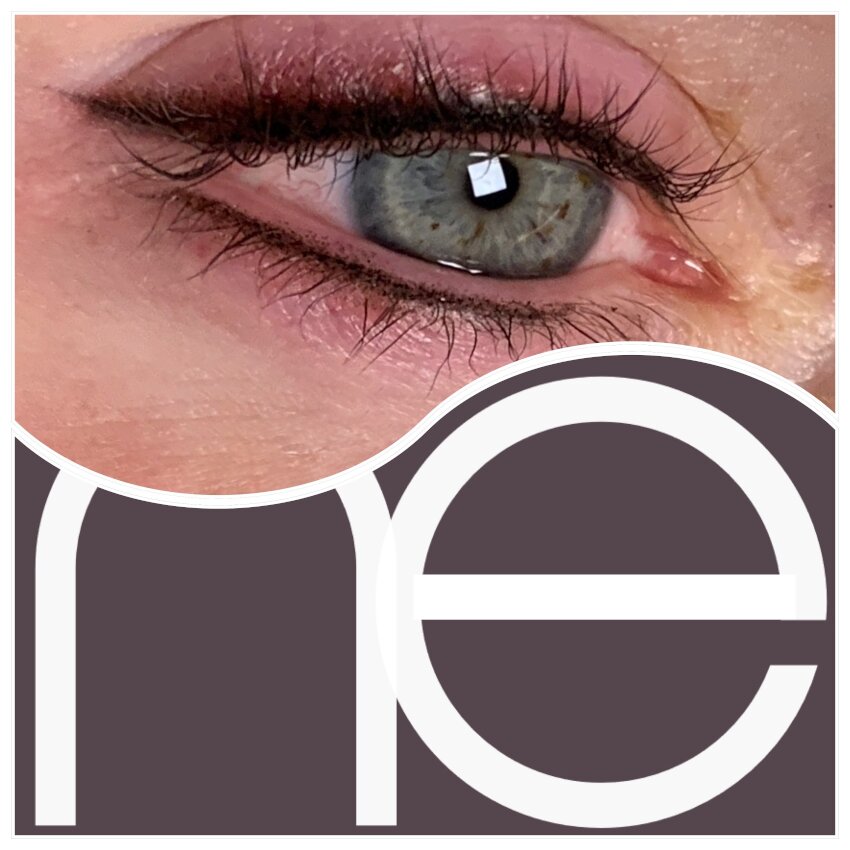 Natural Enhancement Semi Permanent Scar Camouflage Before And After