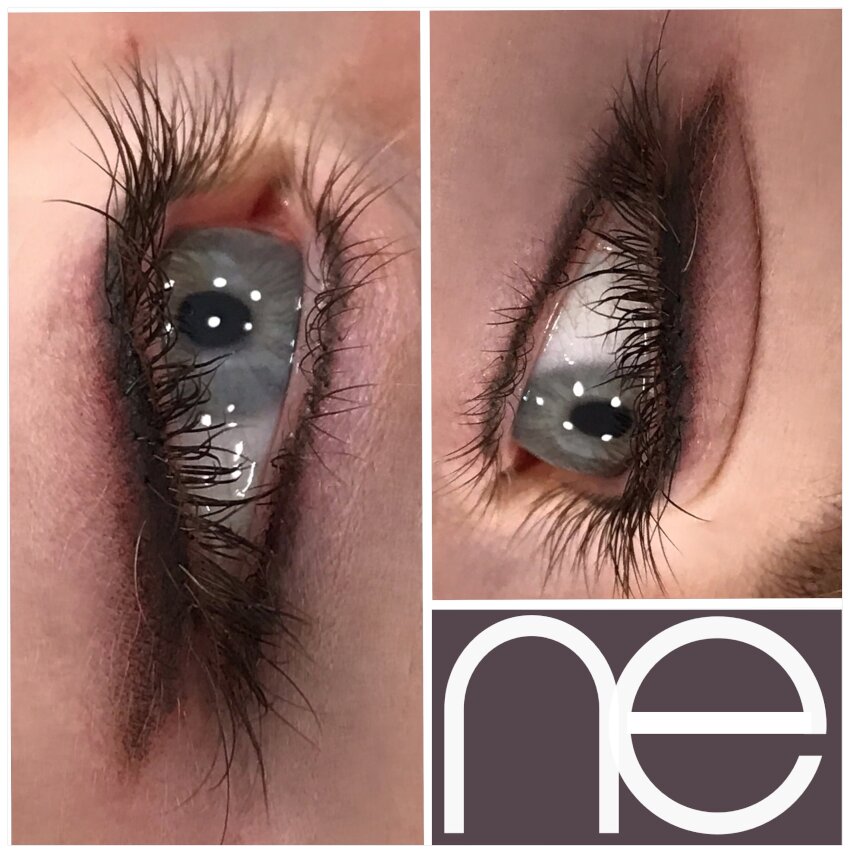 Natural Enhancement Semi Permanent Scar Camouflage Before And After