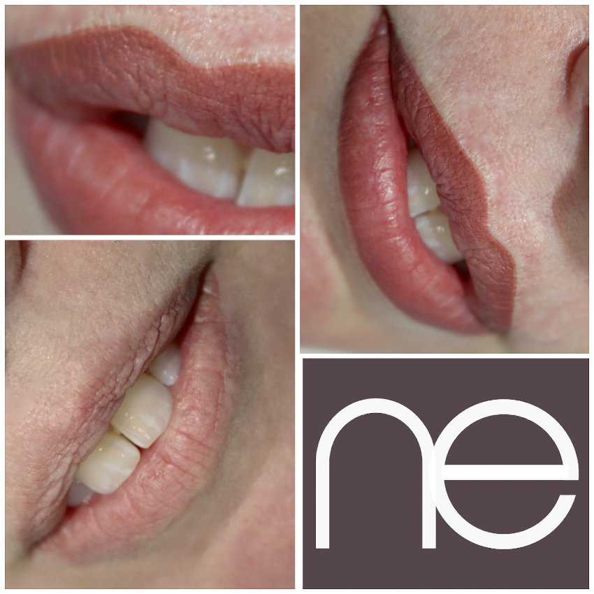 Natural Enhancement Semi Permanent Lips Before And After