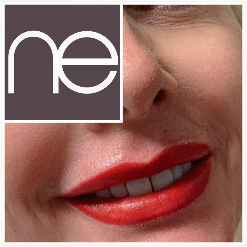 Natural Enhancement Semi Permanent Lips Before And After