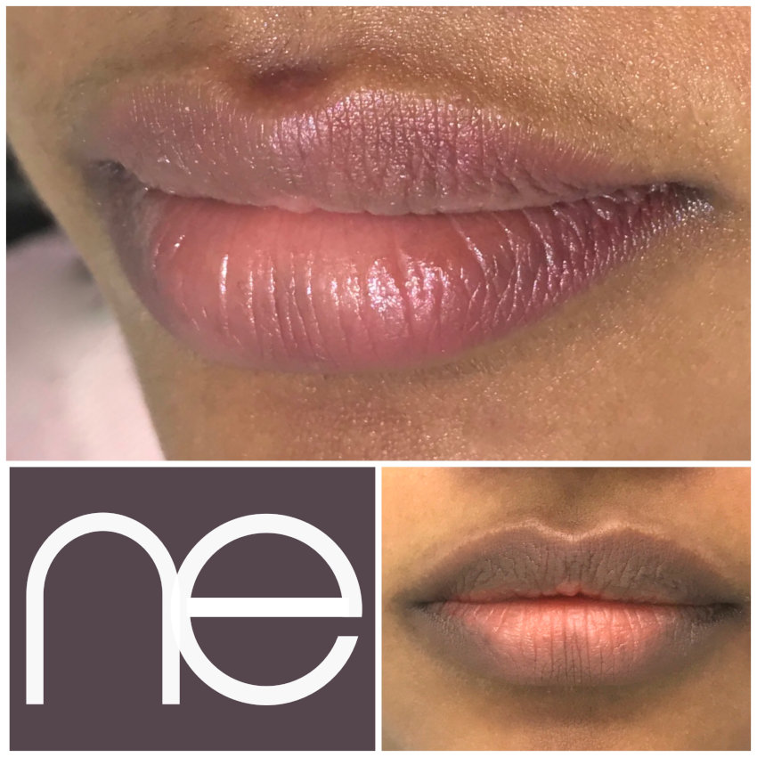 Natural Enhancement Semi Permanent Lips Before And After