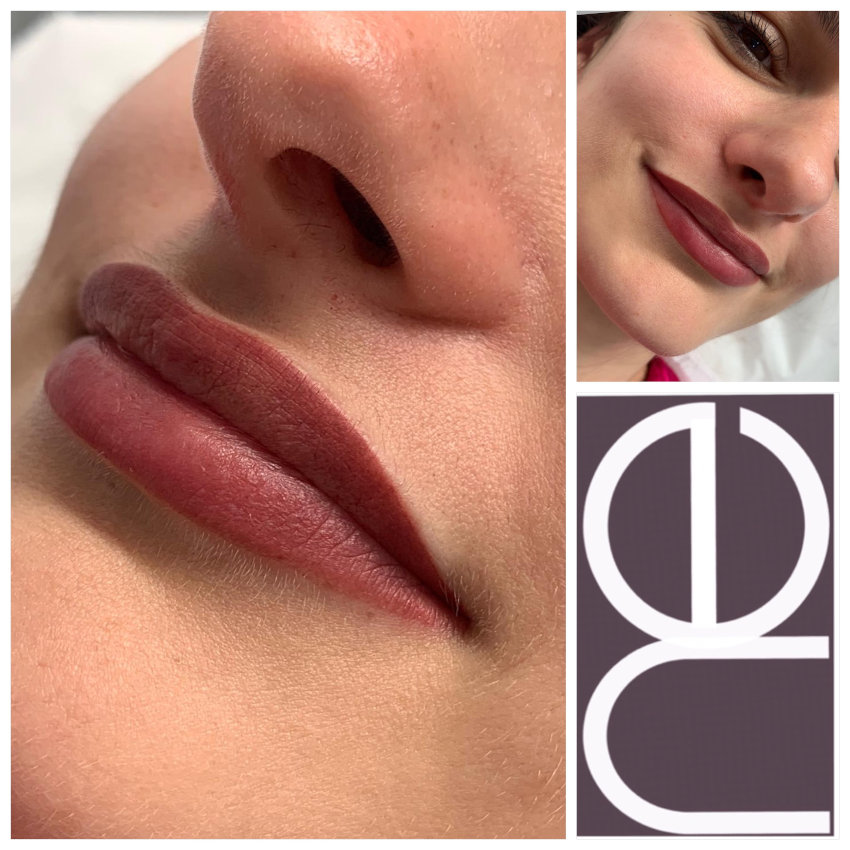 Natural Enhancement Semi Permanent Scar Camouflage Before And After