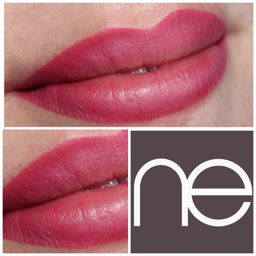 Natural Enhancement Semi Permanent Scar Camouflage Before And After