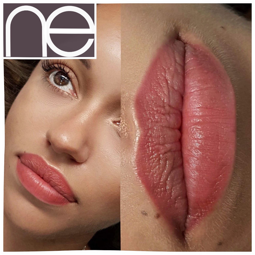 Natural Enhancement Semi Permanent Scar Camouflage Before And After