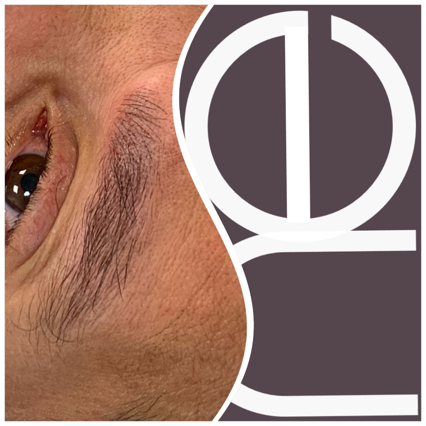 Natural Enhancement Men Before And After