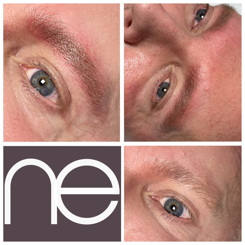 Natural Enhancement Men Before And After