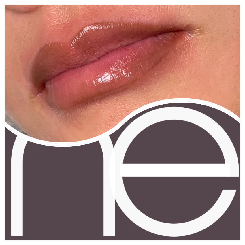 Natural Enhancement Semi Permanent Lips Before And After