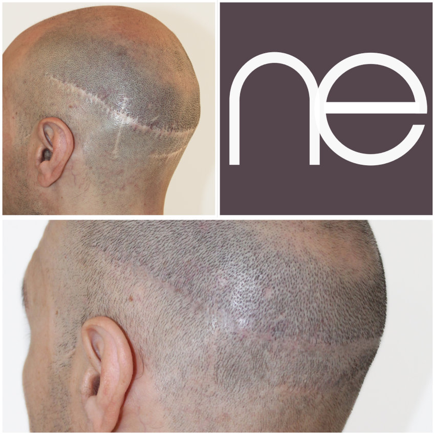 Natural Enhancement Semi Permanent Hair Tattoo Before And After