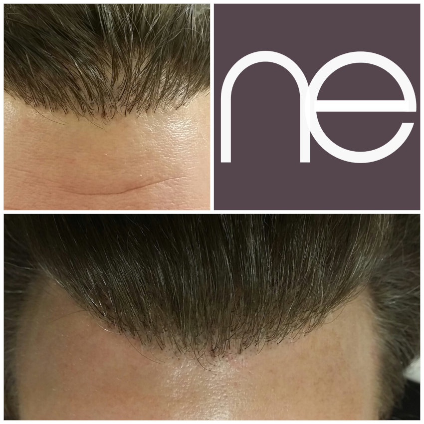 Natural Enhancement Semi Permanent Hair Tattoo Before And After