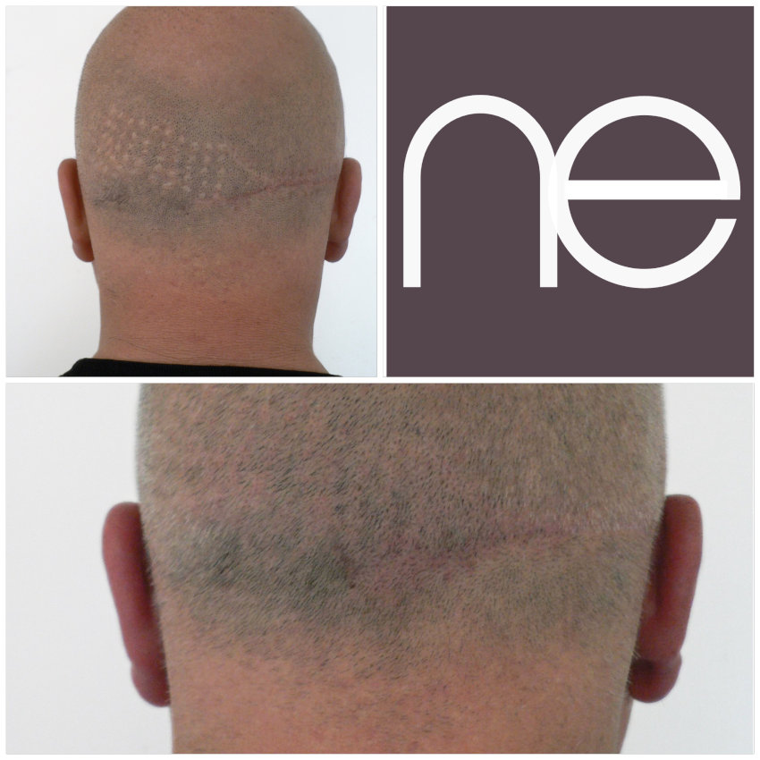 Natural Enhancement Semi Permanent Hair Tattoo Before And After